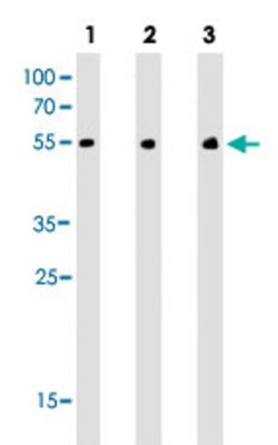 CHRM2 Mouse anti-Human, Mouse, Clone: 1424CT461.78.60, Abnova 400&mu;L;