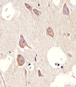 CHRM2 Mouse anti-Human, Mouse, Clone: 1424CT461.78.60, Abnova 400&mu;L;