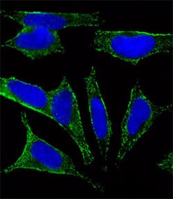 CHRM2 Mouse anti-Human, Mouse, Clone: 1424CT461.78.60, Abnova 400&mu;L;