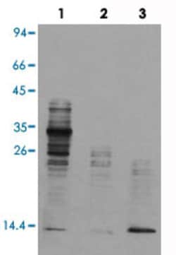 Acetyle Lysine Mouse, Clone: , Abnova 100&mu;L; Unlabeled:Antibodies, Monoclonal