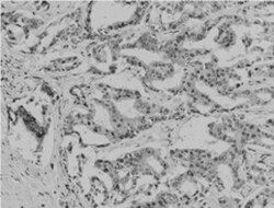 Acetyle Lysine Mouse, Clone: , Abnova 100&mu;L; Unlabeled:Antibodies, Monoclonal