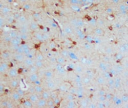 S100B Mouse anti-Human, Rabbit, Rat, Clone: SH-B1, Abnova 100 &mu;g | Buy Online | Abnova | Fisher Scientific