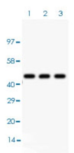 Phosphoserine Mouse, Clone: PSR-45, Abnova 100&mu;g; Unlabeled:Antibodies,