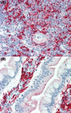 HLA Class II beta chains (DP, DQ, DR) Mouse anti-Human, Clone: WR18, Abnova
