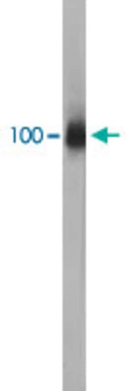 LAMP1 Mouse anti-Human, Clone: 5H6, Abnova 50 &mu;L | Buy Online | Abnova Corporation | Fisher Scientific