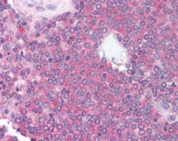 MME Mouse anti-Human, Clone: , Abnova 50&mu;L; Unlabeled:Antibodies, Monoclonal