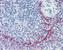 MADCAM1 Mouse anti-Human, Clone: 314G8, Abnova 100&mu;g; Unlabeled:Anticuerpos