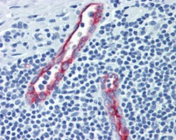 SELP Mouse anti-Human, Clone: Psel.KO.2.5, Abnova 50 &mu;g | Buy Online | Abnova | Fisher Scientific