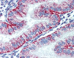 HSPD1 Mouse anti-Human, Clone: LK-2, Abnova 50 &mu;g | Buy Online | Abnova Corporation | Fisher Scientific