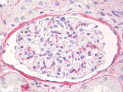 Collagen IV Mouse anti-Human, Clone: PHM-12, Abnova 250 &mu;L | Buy Online | Abnova Corporation | Fisher Scientific