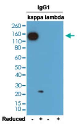Kappa light chain Rabbit anti-Mouse, Clone: RM103, Abnova 100&mu;g; Unlabeled:Antibodies,