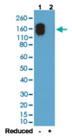 IGG2a, kappa Rabbit anti-Mouse, Clone: RM107, Abnova 100 &mu;g | Buy Online | Abnova Corporation | Fisher Scientific