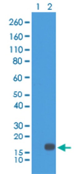 Histone H3(dimethyl K18) Rabbit, Clone: RM168, Abnova 100&mu;g; Unlabeled:Antibodies,