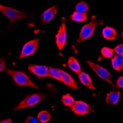 GAPDH Rabbit, Clone: RM114, Abnova 100&mu;g; Unlabeled:Antibodies, Monoclonal