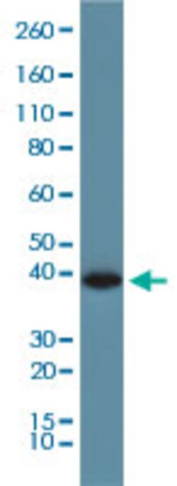 GAPDH Rabbit, Clone: RM114, Abnova 100&mu;g; Unlabeled:Antibodies, Monoclonal