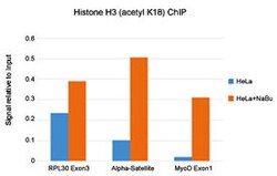 Histone H3(acetyl K18) Rabbit, Clone: RM166, Abnova 100μg; Unlabeled:Antibodies,