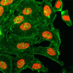 Histone H3(acetyl K18) Rabbit, Clone: RM166, Abnova 100μg; Unlabeled:Antibodies,