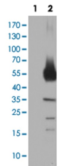 TH Mouse anti-Human, Clone: 1D8, Abnova 50&mu;L; Unlabeled:Antikörper