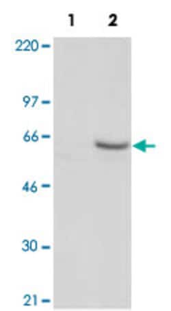 PLK1 (PHO T210 Mouse anti-Human, Clone: 2A3, Abnova 50&mu;g; Unlabeled:Antibodies,