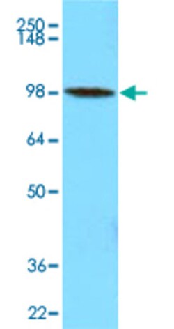 HK3 Mouse anti-Human, Clone: 4F5, Abnova 50&mu;g; Unlabeled:Antibodies,