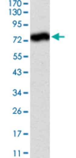 ALPL Mouse anti-Human, Clone: 2F4, Abnova 50 &mu;g | Buy Online | Abnova Corporation | Fisher Scientific