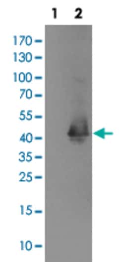 MAPRE2 Mouse anti-Human, Clone: 1F3, Abnova 50 &mu;L | Buy Online | Abnova Corporation | Fisher Scientific