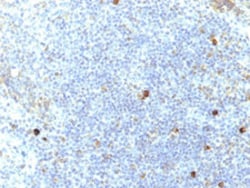 HLA-A25/HLA-AW32 Mouse anti-Human, Clone: SPM417, Abnova 100&mu;g; Unlabeled:Antibodies,