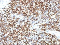 PAX7 Mouse anti-Human, Clone: SPM613, Abnova 100&mu;g; Unlabeled:Antibodies,