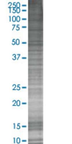 Abnova&trade;&nbsp;SCNN1B 293T Cell Transient Overexpression Lysate (Denatured)