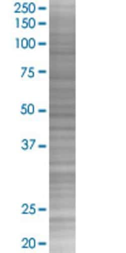 Abnova SCT 293T Cell Transient Overexpression Lysate (Denatured) 100 &mu;L | Buy Online | Abnova&trade; | Fisher Scientific
