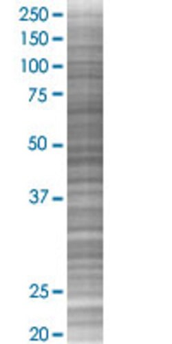 Abnova CCL1 293T Cell Transient Overexpression Lysate (Denatured) (T01) 100 &mu;L | Buy Online | Abnova&trade; | Fisher Scientific