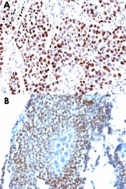 CDKN1A Mouse anti-Human, Clone: CIP1/823, Abnova 100&mu;g; Unlabeled:Antibodies,