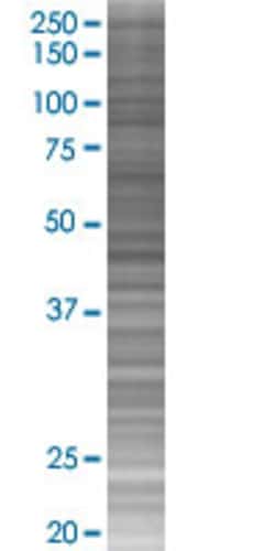 Abnova CXCL6 293T Cell Transient Overexpression Lysate (Denatured) 100 &mu;L | Buy Online | Abnova&trade; | Fisher Scientific