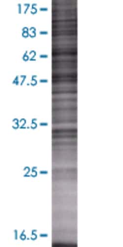 Abnova&trade;&nbsp;SFTPB 293T Cell Transient Overexpression Lysate (Denatured)
