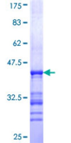 Abnova Human SCG5 Partial ORF (NP_003011, 59 a.a. - 159 a.a.) Recombinant Protein with GST-tag at N-terminal 25 ug | Buy Online | Abnova&trade; | Fisher Scientific