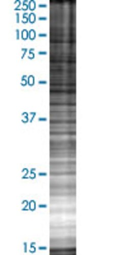 Abnova ST3GAL3 293T Cell Transient Overexpression Lysate (Denatured) (T02) 100&mu;L | Buy Online | Abnova&trade; | Fisher Scientific