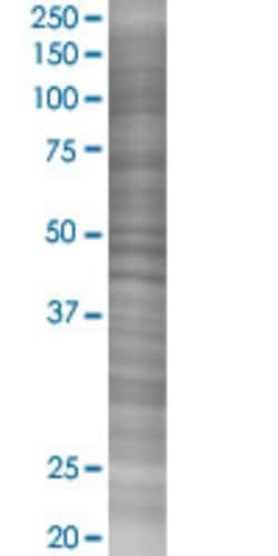 Abnova&trade;&nbsp;SLC1A2 293T Cell Transient Overexpression Lysate (Denatured)