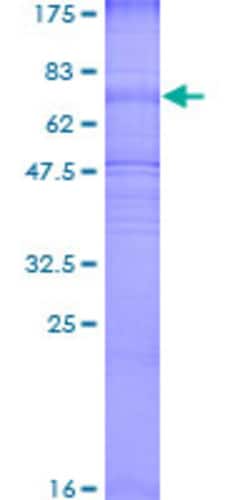 Abnova Human SLC2A3 Full-length ORF (NP_008862.1, 1 a.a. - 496 a.a.) Recombinant Protein with GST-tag at N-terminal 2 &mu;g | Buy Online | Abnova&trade; | Fisher Scientific