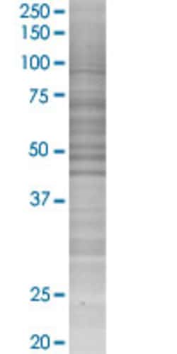 Abnova SLC14A1 293T Cell Transient Overexpression Lysate (Denatured) 100 &mu;L | Buy Online | Abnova&trade; | Fisher Scientific