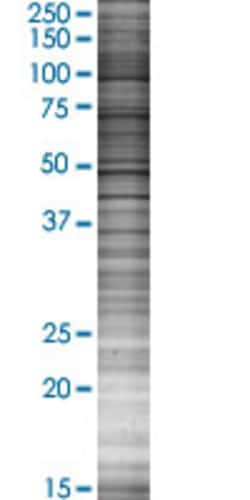 Abnova SLC20A1 293T Cell Transient Overexpression Lysate (Denatured) 100 &mu;L | Buy Online | Abnova&trade; | Fisher Scientific