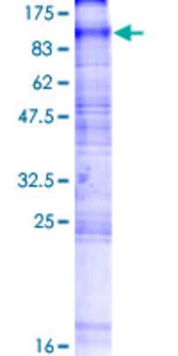 Abnova™ Human SLC20A2 Full-length ORF (NP_006740.1, 1 a.a. - 652 a.a.) Recombinant Protein with GST-tag at N-terminal