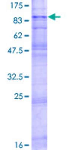 Abnova™ Human SLC22A2 Full-length ORF (NP_003049.1, 1 a.a. - 555 a.a.) Recombinant Protein with GST-tag at N-terminal