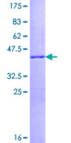 Abnova Human SNCG Full-length ORF (AAH14098.1, 1 a.a. - 127 a.a.) Recombinant Protein with GST-tag at N-terminal 25 ug | Buy Online | Abnova&trade; | Fisher Scientific