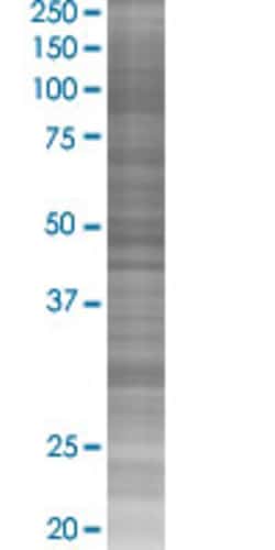 Abnova SNRPA 293T Cell Transient Overexpression Lysate (Denatured) 100 &mu;L | Buy Online | Abnova&trade; | Fisher Scientific