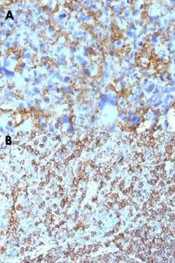 HLA-DRB1 Mouse anti-Human, Clone: LN-3, Abnova 100&mu;g; Unlabeled:Antibodies,
