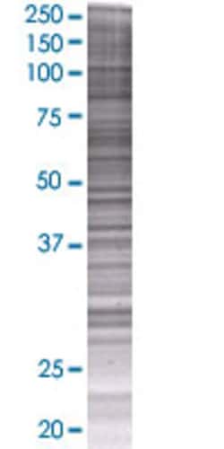Abnova SOX12 293T Cell Transient Overexpression Lysate (Denatured) 100 &mu;L | Buy Online | Abnova&trade; | Fisher Scientific