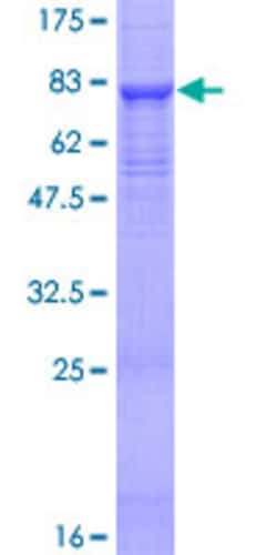 Abnova Human SPAM1 Full-length ORF (NP_694859.1, 1 a.a. - 509 a.a.) Recombinant Protein with GST-tag at N-terminal 2 &mu;g | Buy Online | Abnova&trade; | Fisher Scientific
