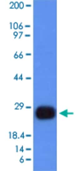 HLA-DRB1 Mouse anti-Human, Clone: HLA-DRB/1067, Abnova 100&mu;g; Unlabeled:Antikörper