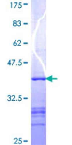 Abnova&trade;&nbsp;Human SPG7 Partial ORF (NP_003110, 655 a.a. - 754 a.a.) Recombinant Protein with GST-tag at N-terminal 25&mu;g 