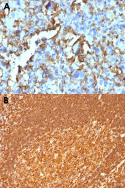 HLA-DRB1 Mouse anti-Human, Clone: HLA-DRB/1067, Abnova 100&mu;g; Unlabeled:Antikörper
